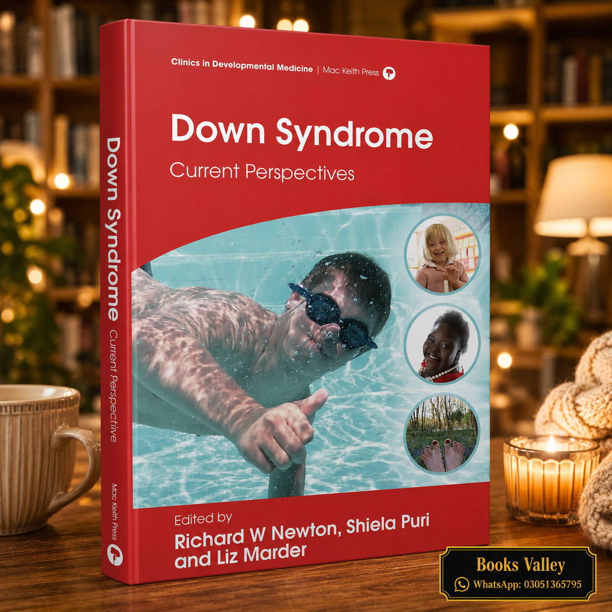 Down Syndrome